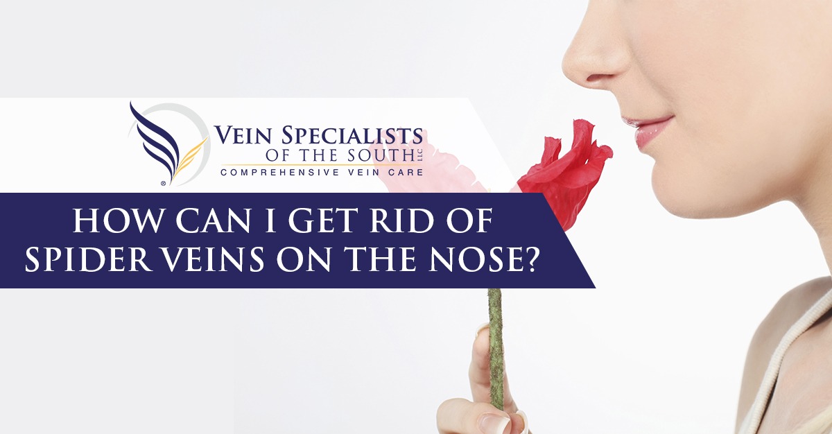 How Can I Get Rid Of Facial Spider Veins Vein Specialists Of The South