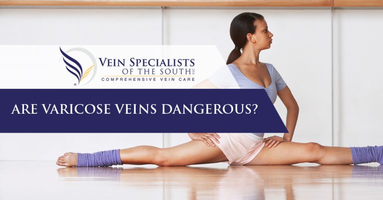 Varicose Veins Are They Dangerous Vein Specialists Of The South 