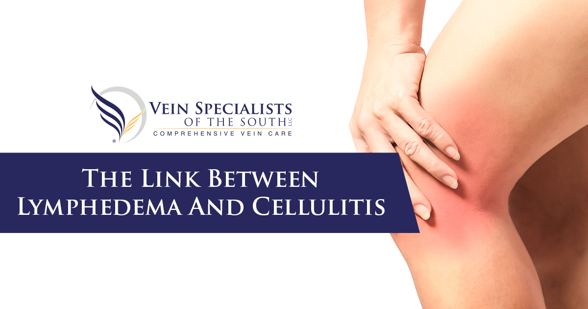 Cellulitis And Lymphedema Vein Specialists Of The South 